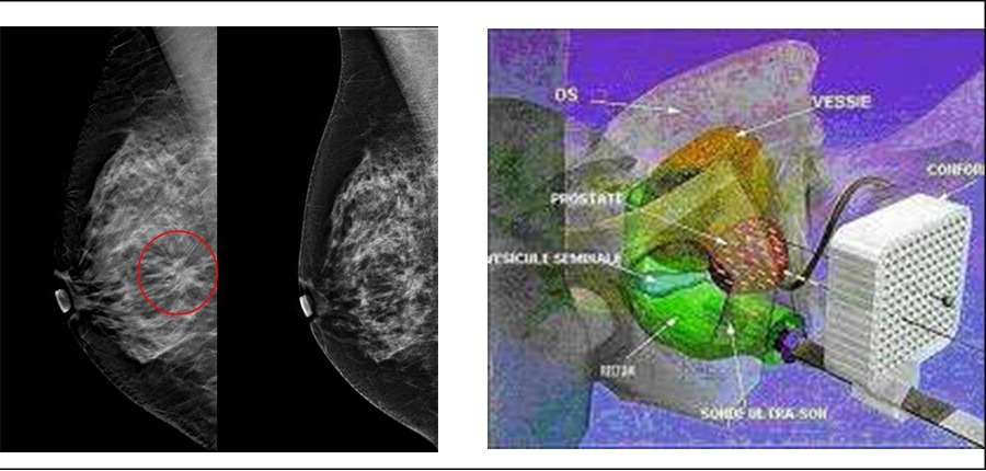 Les Assises AL  AZHAR de formation continue en Cancérologie