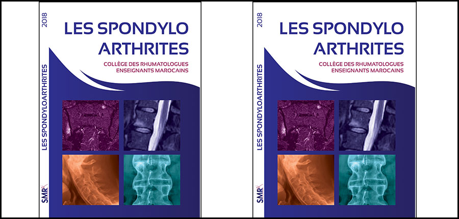 Résultat du travail d’un collège de rhumatologues Enseignants Marocains