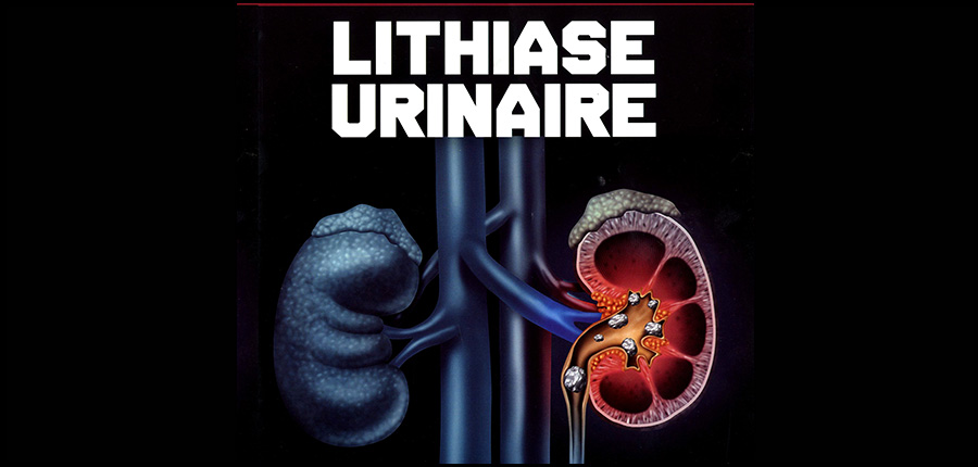 La lithiase urinaire en 4 grandes questions, dans la revue de médecine pratique de janvier 2018