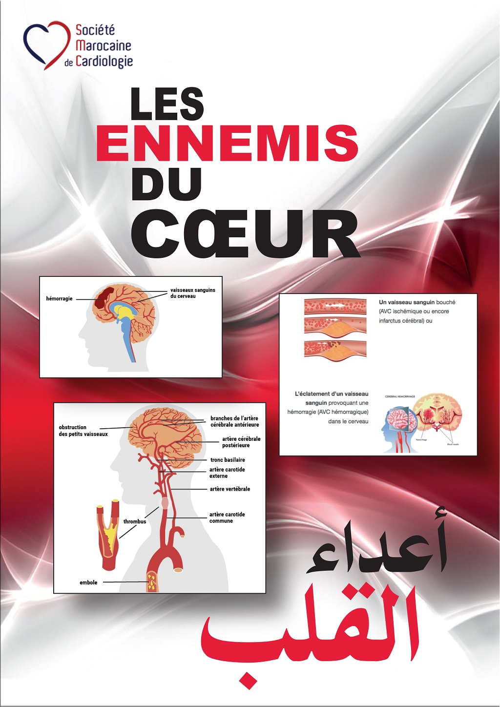 coeur300920171136